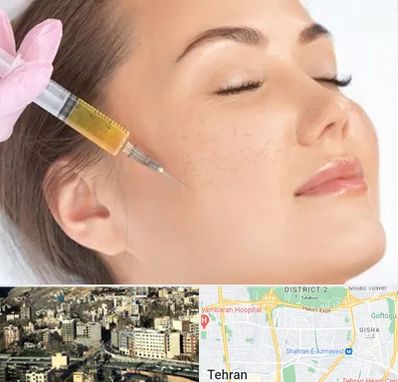 آموزش تزریق ژل و بوتاکس در مرزداران 