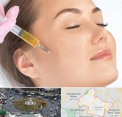 آموزش تزریق ژل و بوتاکس در فردیس کرج 