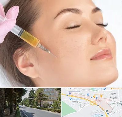 آموزش تزریق ژل و بوتاکس در مهرویلا کرج 