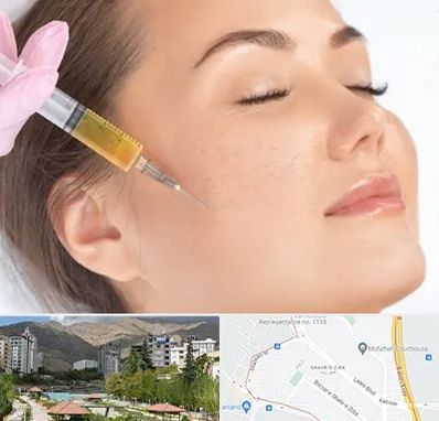 آموزش تزریق ژل و بوتاکس در شهر زیبا 