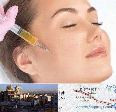 آموزش تزریق ژل و بوتاکس در فرمانیه 