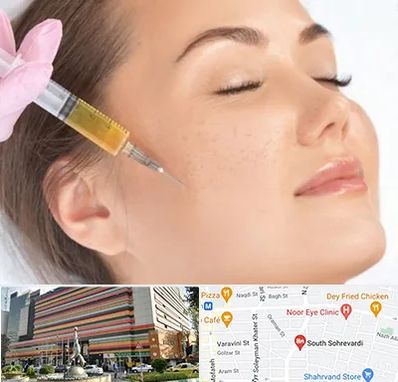 آموزش تزریق ژل و بوتاکس در سهروردی 