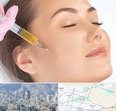 آموزش تزریق ژل و بوتاکس در شمال شرق تهران