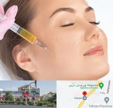 آموزش تزریق ژل و بوتاکس در هروی 