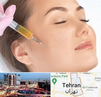 آموزش تزریق ژل و بوتاکس در صادقیه 