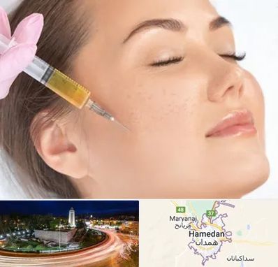 آموزش تزریق ژل و بوتاکس در همدان