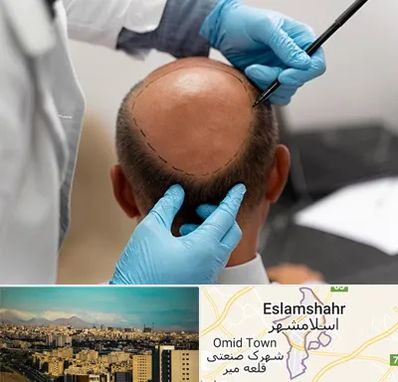 آموزش کاشت مو در اسلامشهر