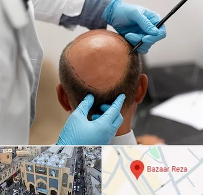 آموزش کاشت مو در بازار رضا مشهد
