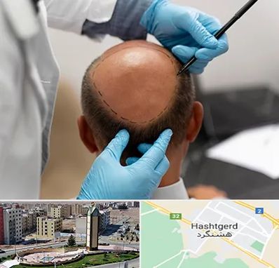 آموزش کاشت مو در هشتگرد
