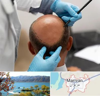 آموزش کاشت مو در مریوان