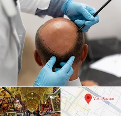 آموزش کاشت مو در بازار وکیل شیراز