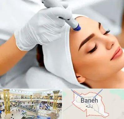 آموزش مزوتراپی در بانه
