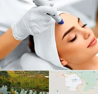 آموزش مزوتراپی در بهبهان