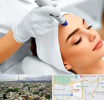 آموزش مزوتراپی در گیشا 