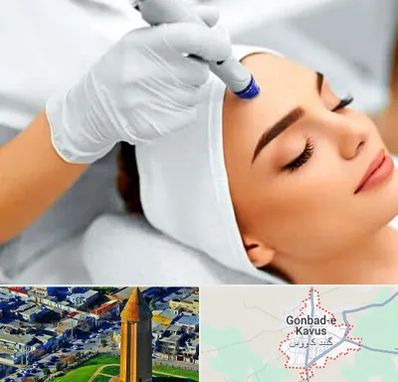 آموزش مزوتراپی در گنبد کاووس
