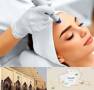 آموزش مزوتراپی در ساوه