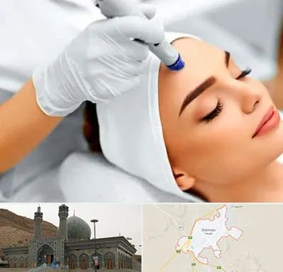آموزش مزوتراپی در شهرضا