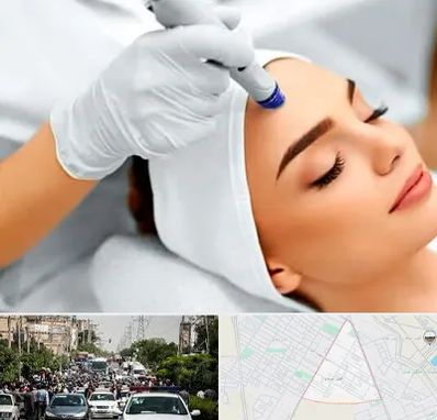 آموزش مزوتراپی در سیدی مشهد