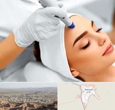 آموزش مزوتراپی در اسفراین
