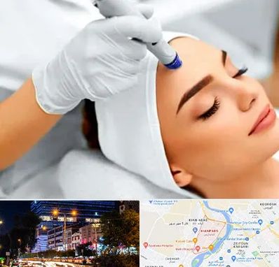 آموزش مزوتراپی در کیانپارس اهواز 