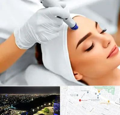 آموزش مزوتراپی در هفت تیر مشهد 