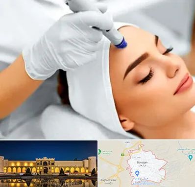 آموزش مزوتراپی در برازجان