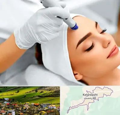 آموزش مزوتراپی در کلاردشت