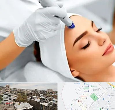 آموزش مزوتراپی در شمیران نو