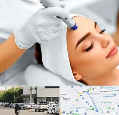 آموزش مزوتراپی در قدوسی شرقی شیراز 