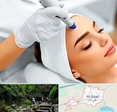 آموزش مزوتراپی در علی آباد کتول