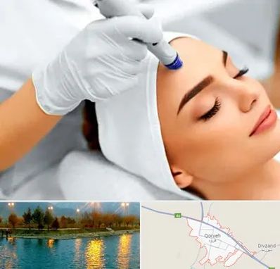 آموزش مزوتراپی در قروه