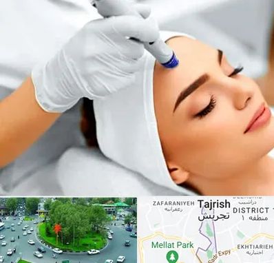 آموزش مزوتراپی در تجریش 