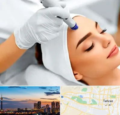 آموزش مزوتراپی در غرب تهران 