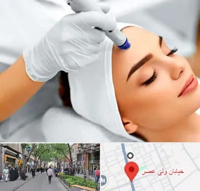 آموزش مزوتراپی در ولیعصر شهریار