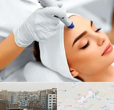 آموزش مزوتراپی در محمد شهر کرج 