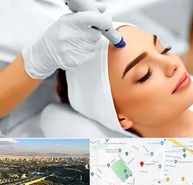 آموزش مزوتراپی در هنگام 