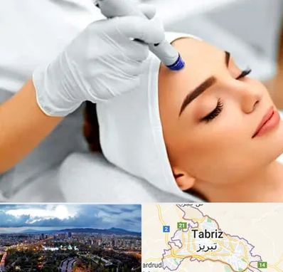 آموزش مزوتراپی در تبریز