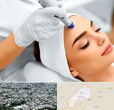 آموزش مزوتراپی در شاهرود
