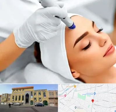 آموزش مزوتراپی در زنبیل آباد قم