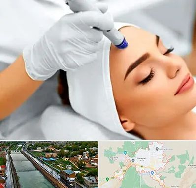آموزش مزوتراپی در مراغه