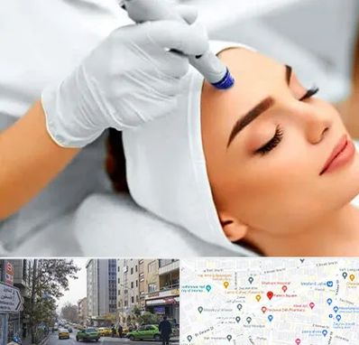 آموزش مزوتراپی در فاطمی 