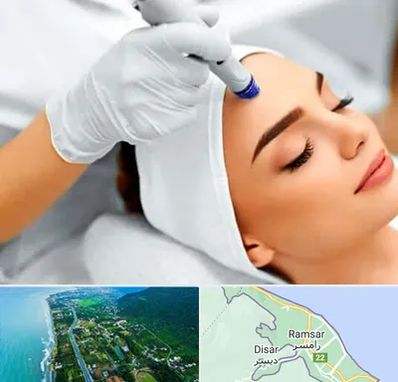 آموزش مزوتراپی در رامسر