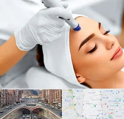 آموزش مزوتراپی در منطقه 10 تهران 