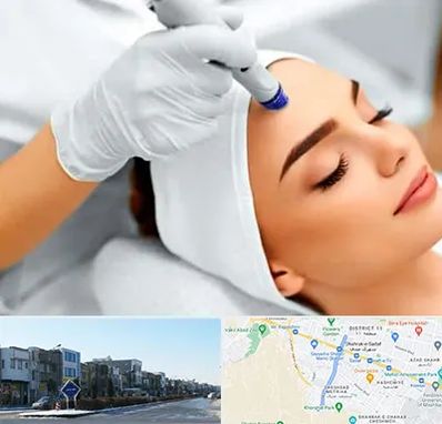 آموزش مزوتراپی در شریعتی مشهد 