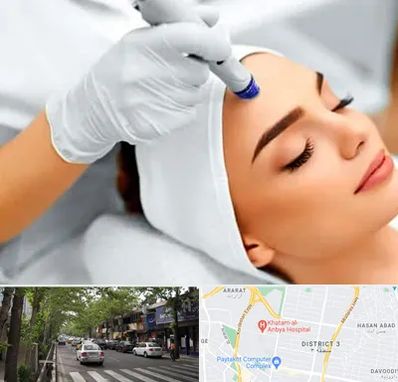 آموزش مزوتراپی در ظفر 