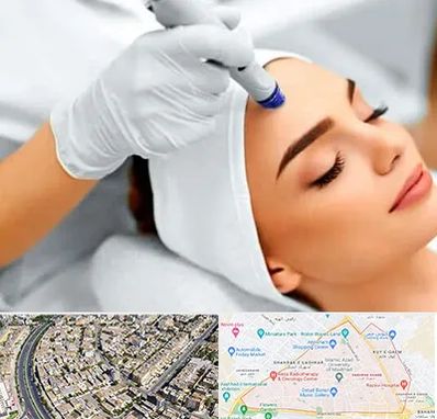 آموزش مزوتراپی در شهرک غرب مشهد 