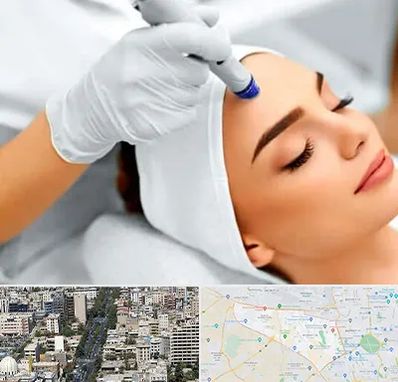 آموزش مزوتراپی در منطقه 18 تهران 