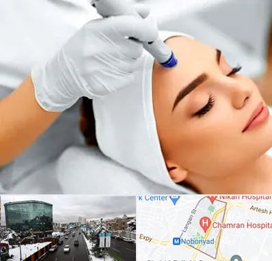 آموزش مزوتراپی در اقدسیه 