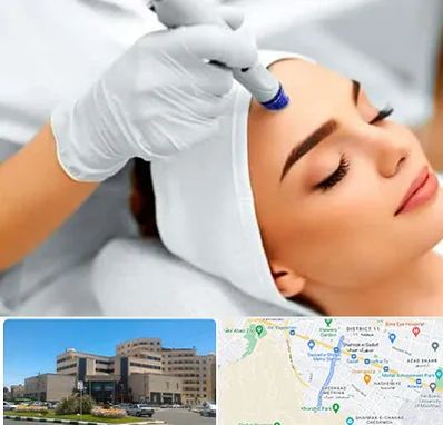 آموزش مزوتراپی در صیاد شیرازی مشهد 