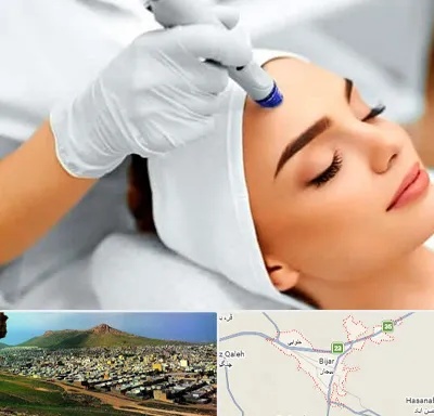 آموزش مزوتراپی در بیجار